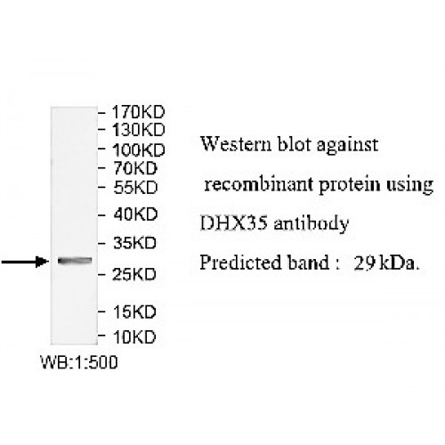 DHX35 Antibody Supplier | AOBIOUS