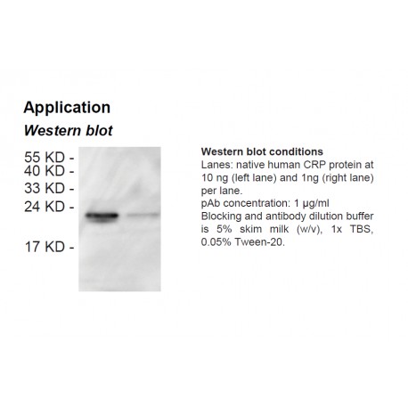 Rabbit anti-human C-reactive protein (CRP) polyclonal antibody